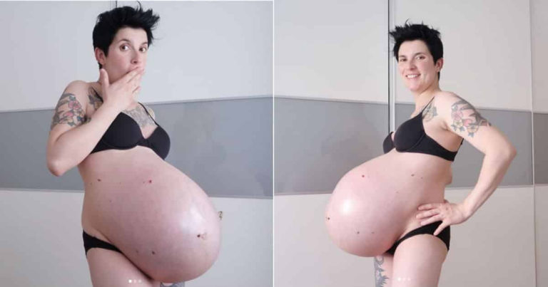 Mãe demonstração conforme ficou sua barriga posteriormente a gravidez de gêmeos e a realidade anima outras mães