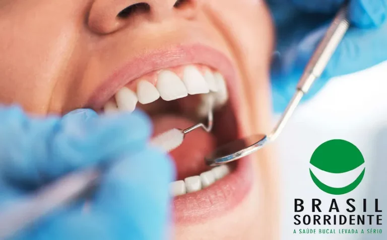 Brasil Sorridente: Como conseguir implante dentário pelo SUS