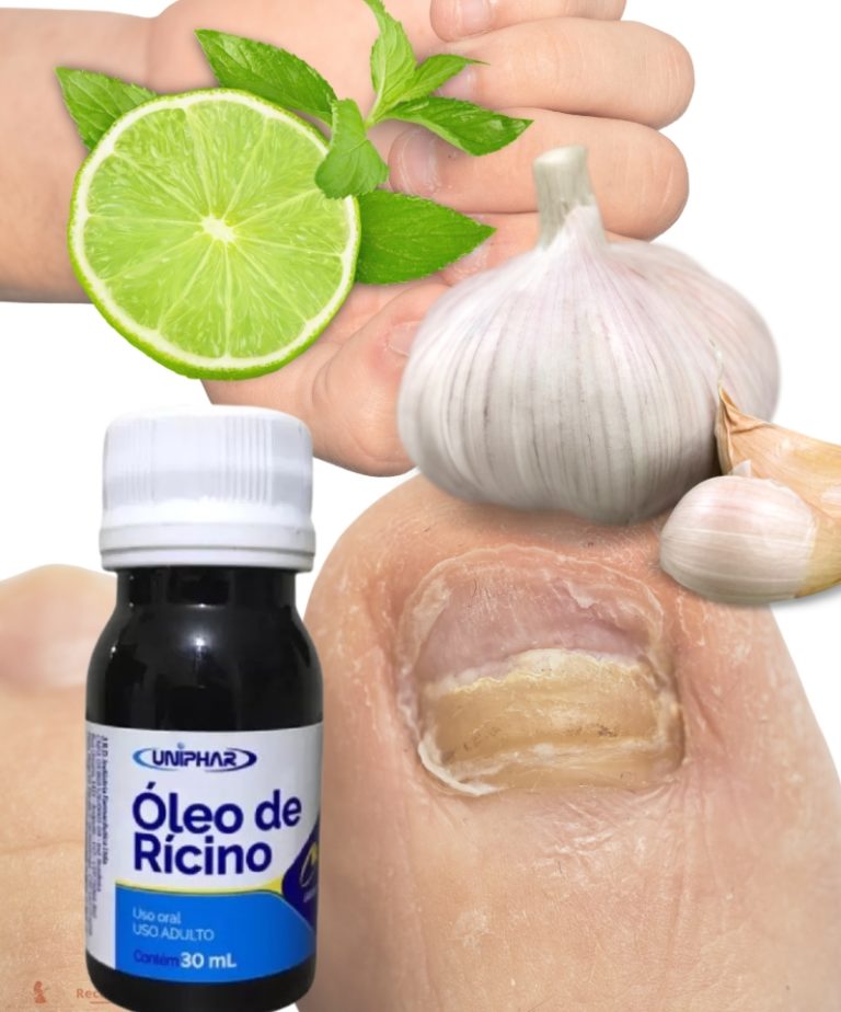 4 receitas pra deixar as unhas fortes